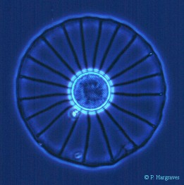 Diatome2