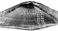 otolith